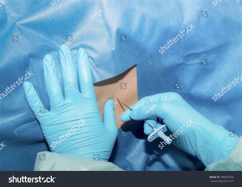 4 Hundred Cesarean Section Anesthesia Royalty Free Images Stock
