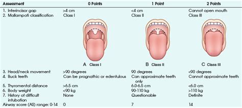 Mallampati Airway Score