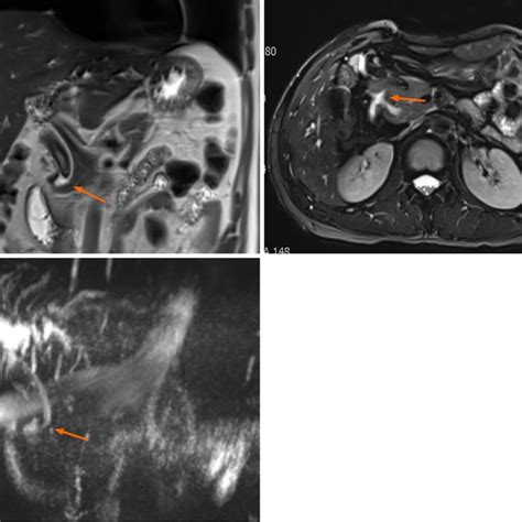 Magnetic Resonance Imaging Findings Magnetic Resonance Imaging Showed Download Scientific