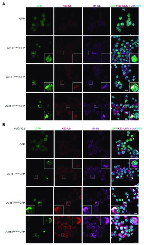 Cytoplasmic Aggregates Of Truncated TDP 43 Include K63 And