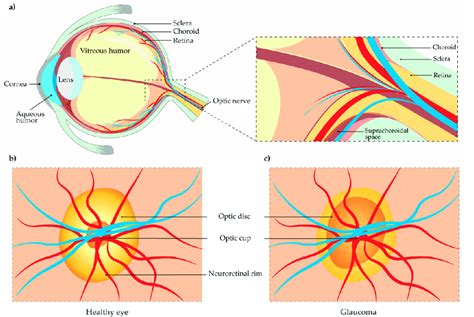 A Morphology Of The Eye B Optical Nerve Head In A Healthy Eye C