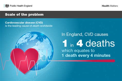 Health Matters Preventing Cardiovascular Disease GOV UK