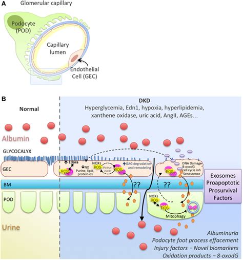 Working Model Of Endothelial Cellpodocyte Cross Talk In Diabetic