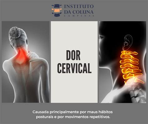 Dor Cervical Instituto Da Coluna Campinas