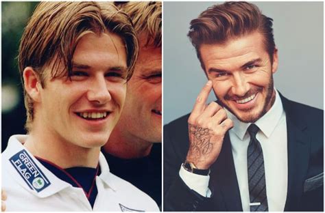 20 Fotos de famosos antes y después de usar brackets Lab coat Fashion