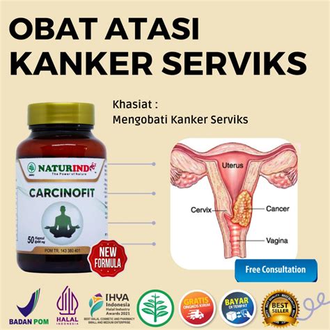 Jual Obat Kanker Serviks Tumor Benjolan Polim Rahim Servik Serfiks