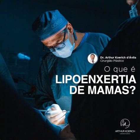 O Que é Lipoenxertia De Mamas Dr Arthur Koerich