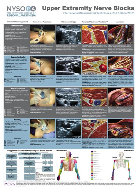 17 Best Images About Anesthesia On Pinterest Medicine Spinal Cord