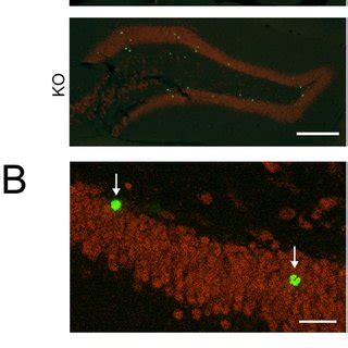 A Representative Photomicrographs Of Brdu Green And Neun Red