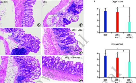 The Histologic Findings And Score Of Colonic Mucosa A D Adigfbp 3