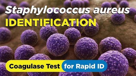 How To Identify Staphylococcus Aureus Using The Coagulase Test Slide