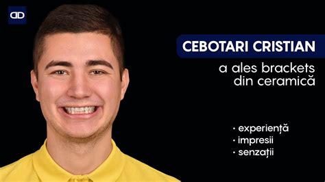 Cristian Cebotari Brackets de Ceramică YouTube