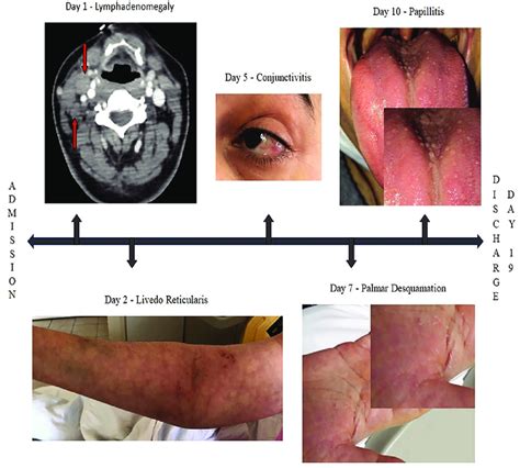 The Mucocutaneous And Radiological Findings Of Case 1 Download