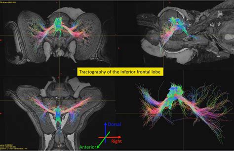 Squid brain could boost new technologies - Vida Newspaper