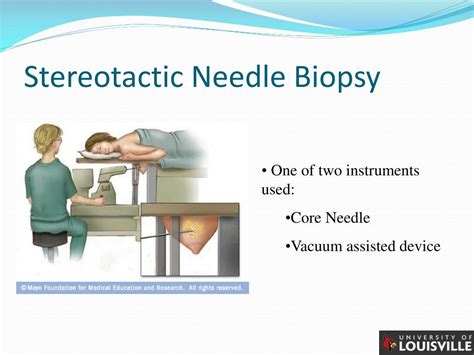 Stereotactic Core Needle Biopsy Procedure | Hot Sex Picture