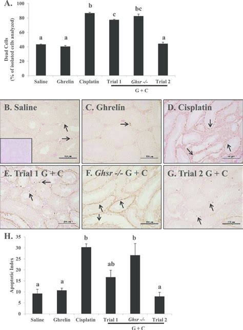 Cisplatin Induced Testicular Cell Death Diminished By Ghrelin