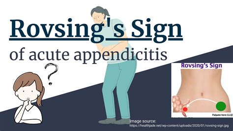 Rovsings Sign Of Acute Appendicitis Novice Medic Youtube