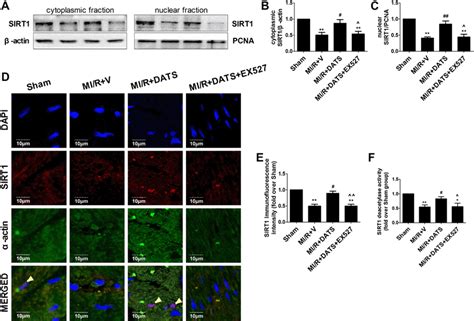 The Effects Of Dats And Ex527 On Sirt1 Intracellular Distribution And