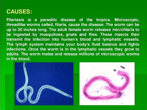 Elephantiasis presentation1