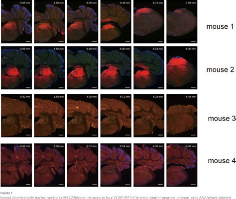 Figure 7 From Whole Brain Monosynaptic Outputs And Presynaptic Inputs