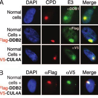 Ddb Cul A Ddb Ubiquitin Ligase Colocalizes With Uv Damaged Dna In