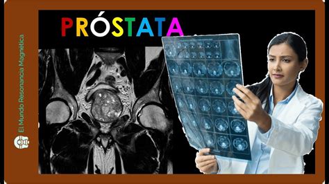 Se Ales Ocultas Del C Ncer De Pr Stata En Resonancia Magn Tica