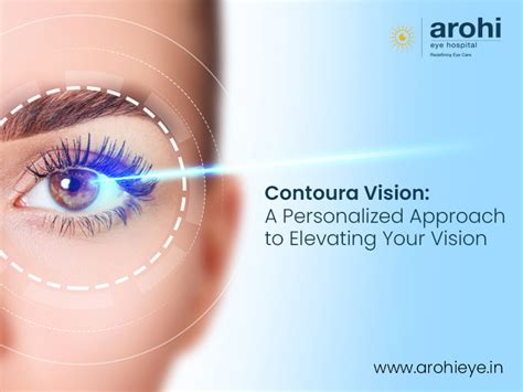 Contoura Vision A Personalized Approach To Elevating Your Vision