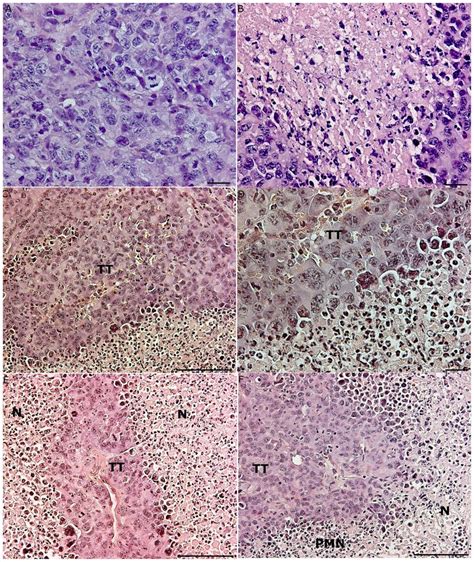 Histology of tumor tissues from mice with or without AT. (A) Fourteen ...