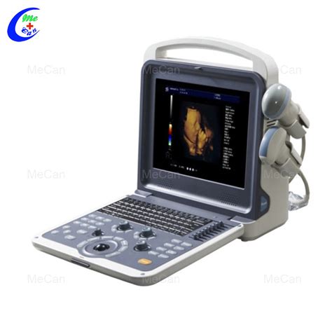 Quality Portable Full Digital Color Doppler Ultrasound Diagnostic