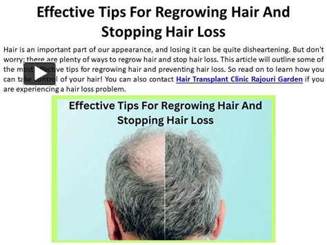 Ppt Therapies That Work To Increase Hair Growth And Prevent Hair Loss