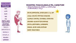 Comminuted Fracture: What Is It, Examples, and More | Osmosis