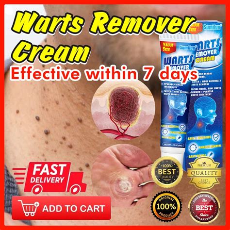 Favorable Rate G Plantar Warts Remover Original Gamot Sa Kulugo