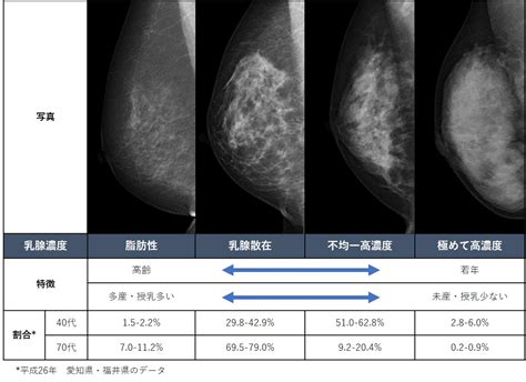 乳がん検診でよく記載されている分類 六本木ブレストレディースクリニック 港区の乳腺外科・婦人科 女医