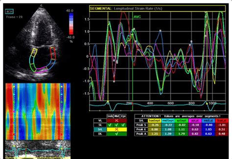 A representative case of strain rate measurement | Download Scientific Diagram