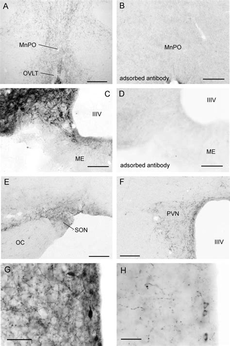 Distribution Of Kisspeptin Immunoreactive Fibers In The Mouse