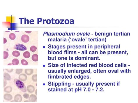 Ppt The Protozoa Powerpoint Presentation Free Download Id1471902