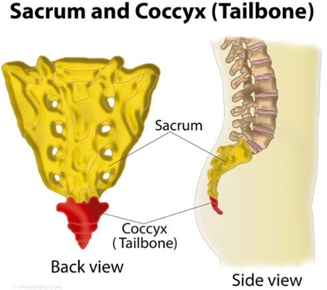 Coccigodinia Dolore Coccige Cura Con Onde D Urto Focali A Firenze