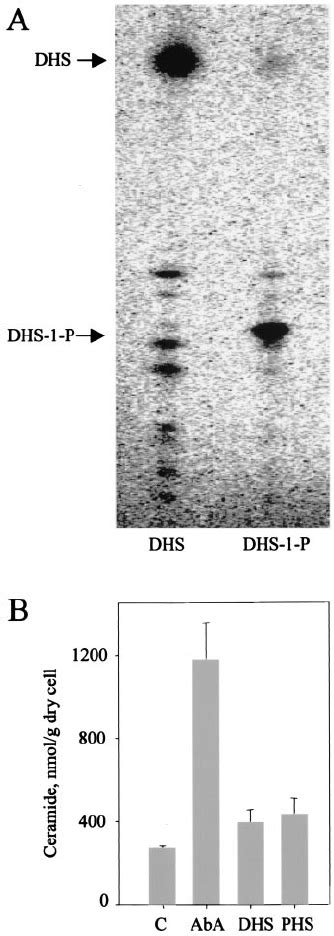 Sphingolipid Analysis A Autoradiogram Of Stable Sphin Golipid Bases