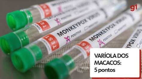 Marca De Vacina No Bra O Indica Prote O Contra Var Ola Dos Macacos