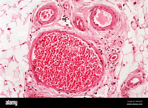 Micrograph Of Blood Vessel Hi Res Stock Photography And Images Alamy