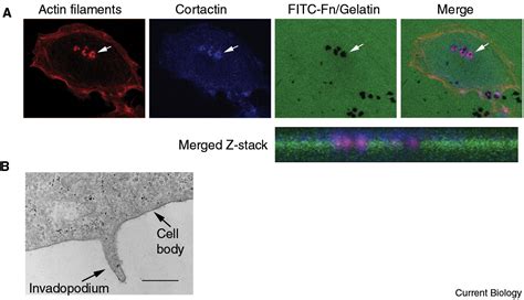 Invadopodia Current Biology