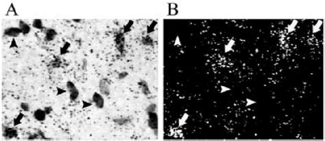 Bright Field A And Darkfield B Photomicrographs Of The Same