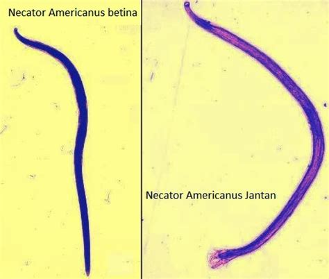 Necator Americanus Dan Ancilostoma Duodenale Sehat Online