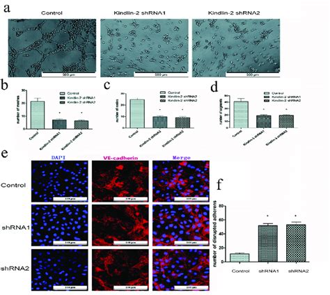 Down Regulation Of Kindlin 2 Expression Inhibits Cellular Tube