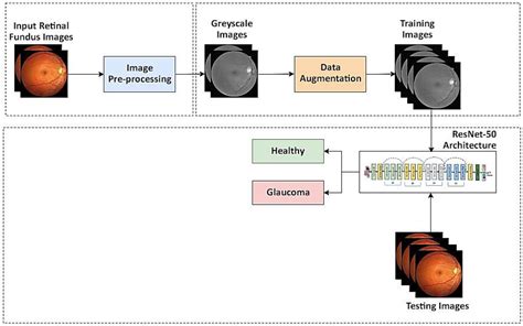 Diagnostics Free Full Text Automatic Diagnosis Of Glaucoma From