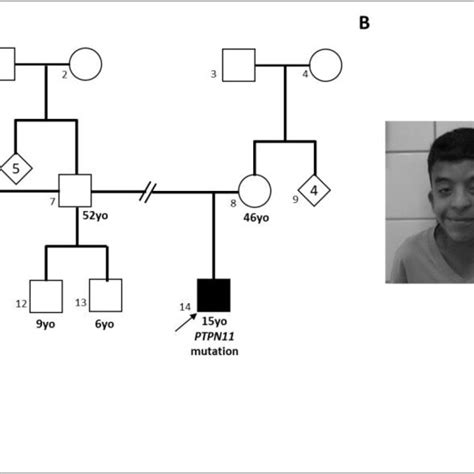 Clinical Features Of Two Probands With Noonan Syndrome Download