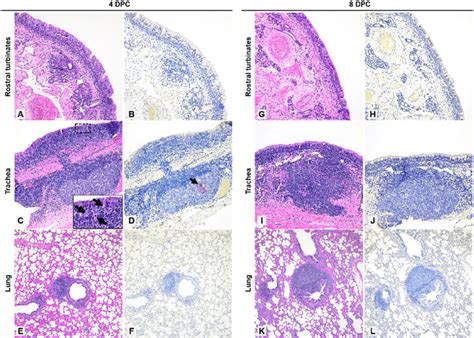 Histopathology And Sars Cov Antigen Distribution In The Upper And