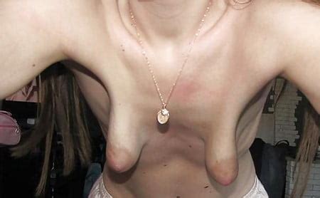 A Saggy Empty Tits Whore Who Posted Her Tits On A Page Immagini XHamster