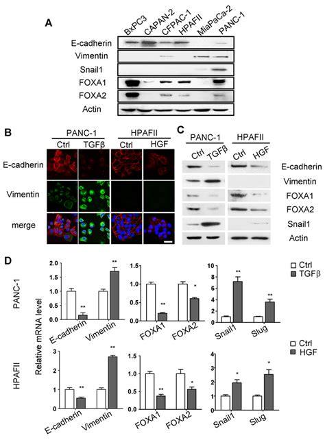 FOXA1 And FOXA2 Are Suppressed During EMT In Vitro A Expression Of