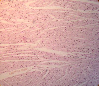 Heart Histology - Papillary muscle - histology slide